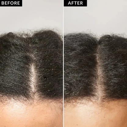 Nuriva Scalp Detox Comb
